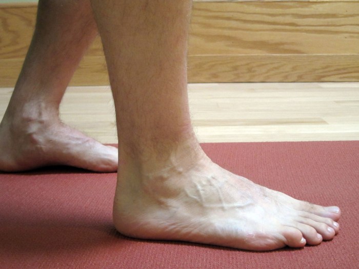 How can you prevent yourself from spraining your ankle apex